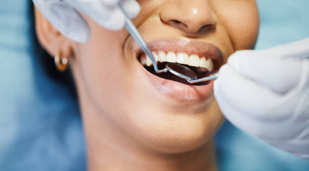 Best Emergency Dentist for Lost Fillings or Crowns in Girard, KS